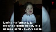 Dečak čudo: Doktori mu predvideli nekoliko sati, sada ima sedam godina i čeka operaciju koja će mu promeniti život