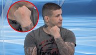 Bakočević o meču sa slomljenom šakom: Išao sam glavom kroz zid, takav mi je "majnd set"