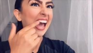 Htela da bude lepa za Instagram pa provalila da su joj prljavi zubi