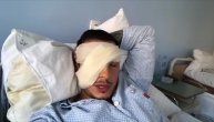 Drama popularnog srpskog MMA borca: Dušan Džakić u borbi da sačuva vid, okrenuo se Bogu!