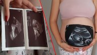 Bliznakinje iz Hrvatske najboljoj drugarici oslikale trudnički stomak