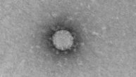 Prvi mikroskopski snimci korona virusa
