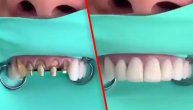 Stomatolog postao zvezda na internetu: Snimak kako popravlja zube pogledalo je više hiljada ljudi
