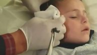 Snimak vađenja gelera iz glave azerbejdžanskog dečaka