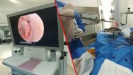 Prepisali su mu kapi za uši, a on je završio na operaciji: Greškom ih je zamenio super lekom