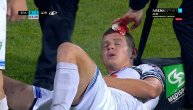 Nikolić kopačkom pocepao glavu Jezdimiroviću: Igrač Zlatibora krvav završio meč