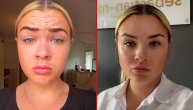 "Izgledaš 10 godina starije!": Mlada devojka stavila botoks, pa se šokirala zbog komentara