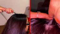 Novi bizarni trend pokorio TikTok: Čupaju vlasište glave da bi čuli zvuk pucanja