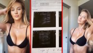 Radila ultrazvuk da bi dokazala da nema silikone: Influenserka iz Slovačke dominira