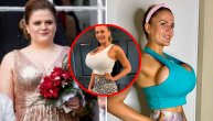 Skinula kilograme, a dobila preogromne grudi: Čudesna transformacija posle teških životnih udaraca
