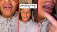 Tiktokerka snimala natečene i modre usne nakon estetskog zahvata: "Bole me, plačem ali vredi"