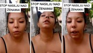 "Pokidao je sa sebe majicu i davio me njom": Žrtva nasilja pokazala podlive i modrice od muža