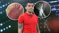 Džoker Ilić pokazao povrede posle spektakularne pobede: Podlaktica pukla, a stopalo kao balon