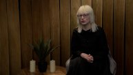 Svetlana Sumi ima albinizam i tešku životnu priču koja lomi i najtvrđa srca