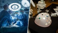 Stručnjaci nemaju dilemu: Šta da očekuje pacijent iz Srbije od robota-hirurga u operacionoj sali?
