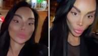 Snimak Tamare Đurić nakon novih plastičnih operacija: Šta kažete na ove promene izgleda starlete?