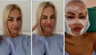 Bivša zadrugarka se snimala pre i posle plastičnih intervencija na licu