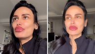 Indi pokazala novo lice: Šok snimak pevačice korekcija na usnama i obrvama