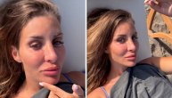 Jelena Radanović u velikom problemu: "Opada  mi kosa, imam proširene vene, a pogledajte tek osip"