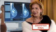 Aleksandra Bogićević i borba protiv raka dojke: Ovo treba da čuje svako - RADNO